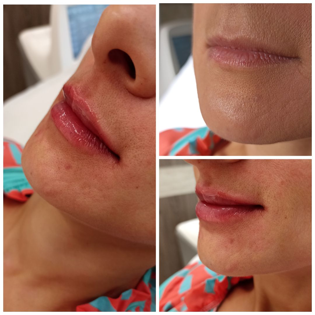 Michalina Zagańczyk-Bączek-2