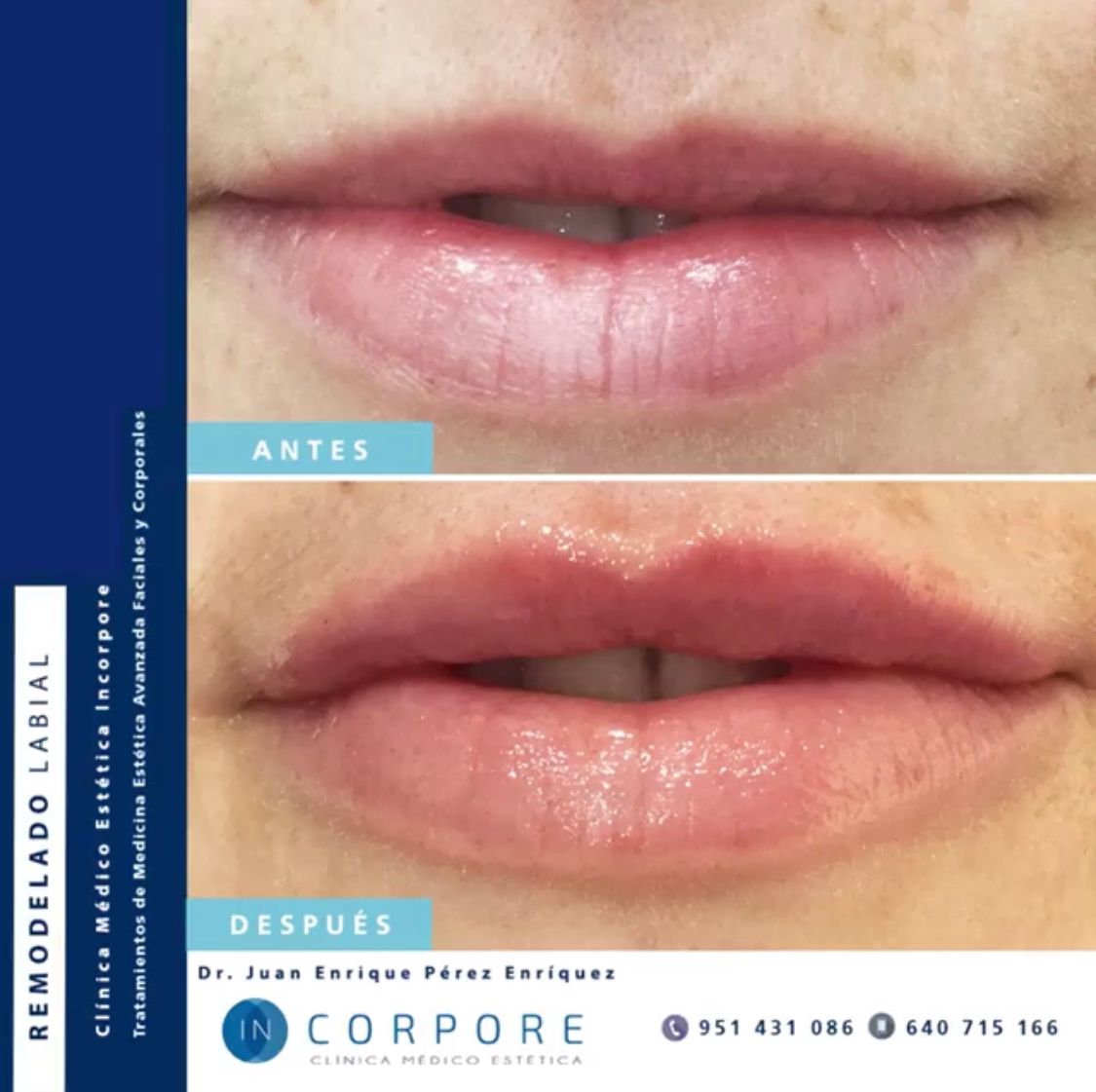 Juan Enrique Pérez Enríquez-110