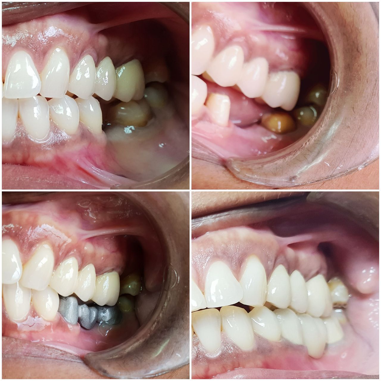 Arabel Fis Rodríguez-25