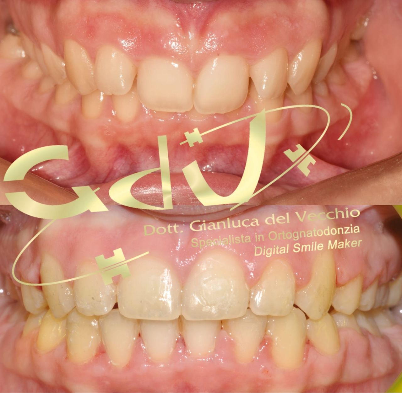 Gianluca Del Vecchio-185