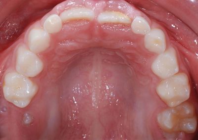 Catharina Zantner-12