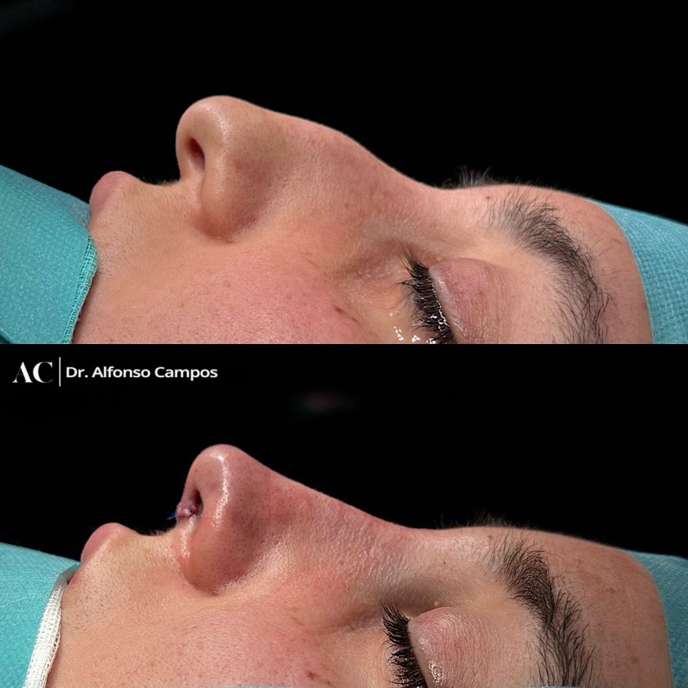 Alfonso Campos Gonzalez-0