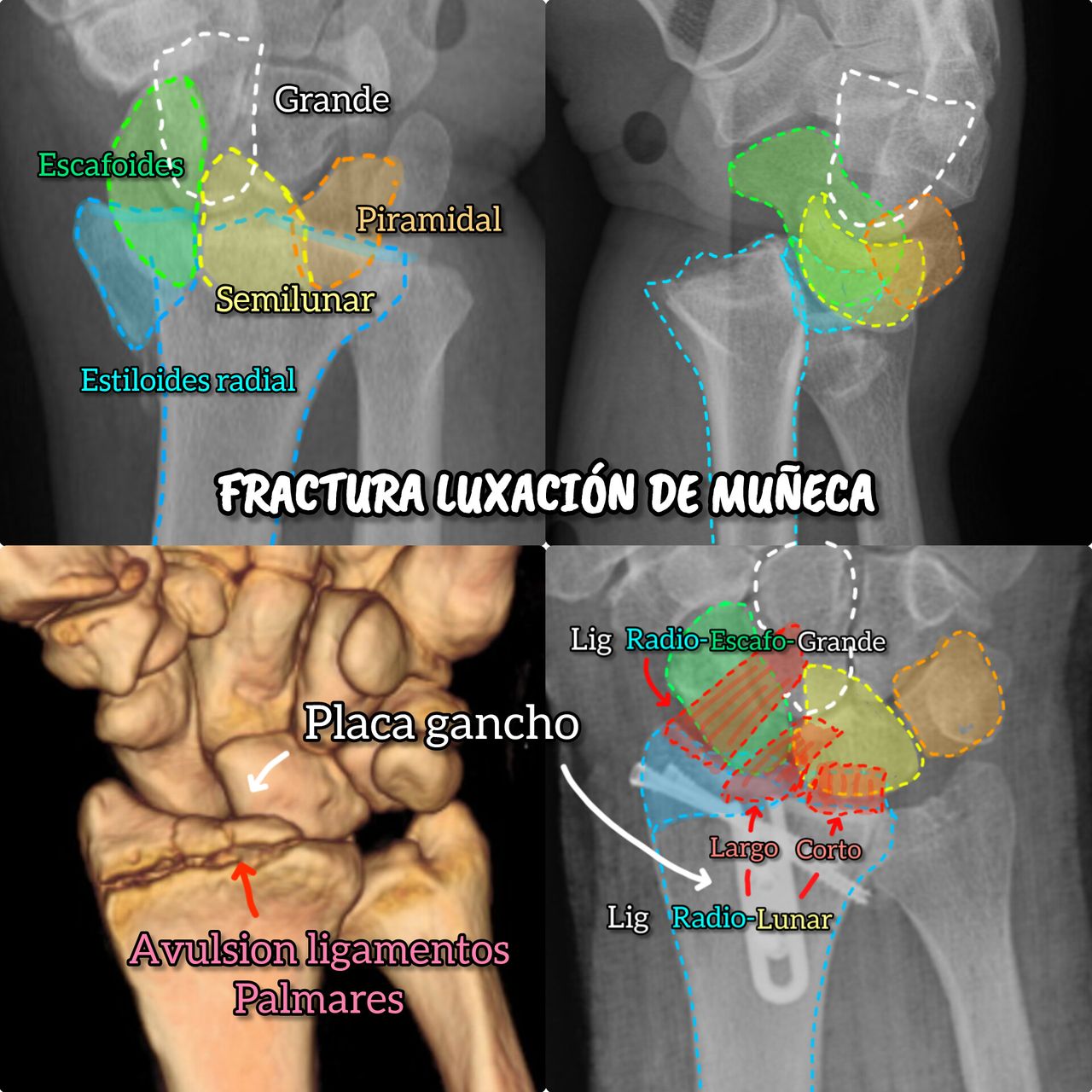 Derlis Sotelo García-16