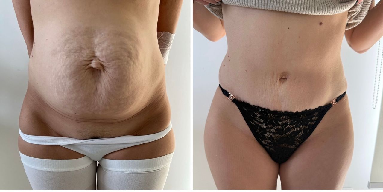 Fabrizio Barattolo-20