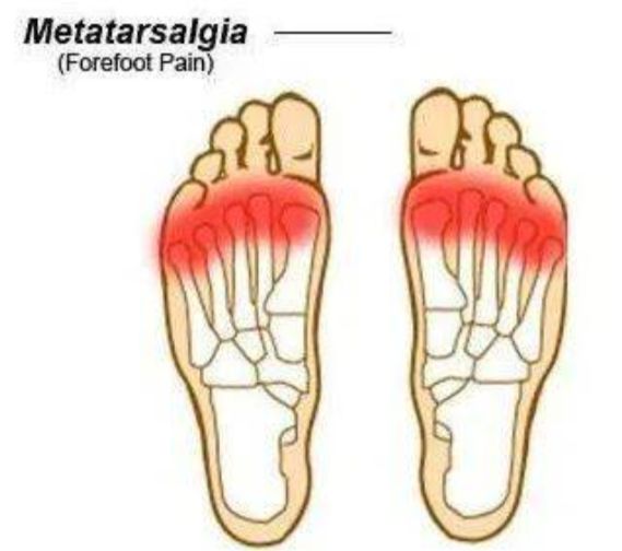 Francesca Montaquila-15