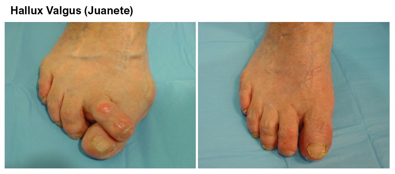 Luis Castillo Sanchez-6