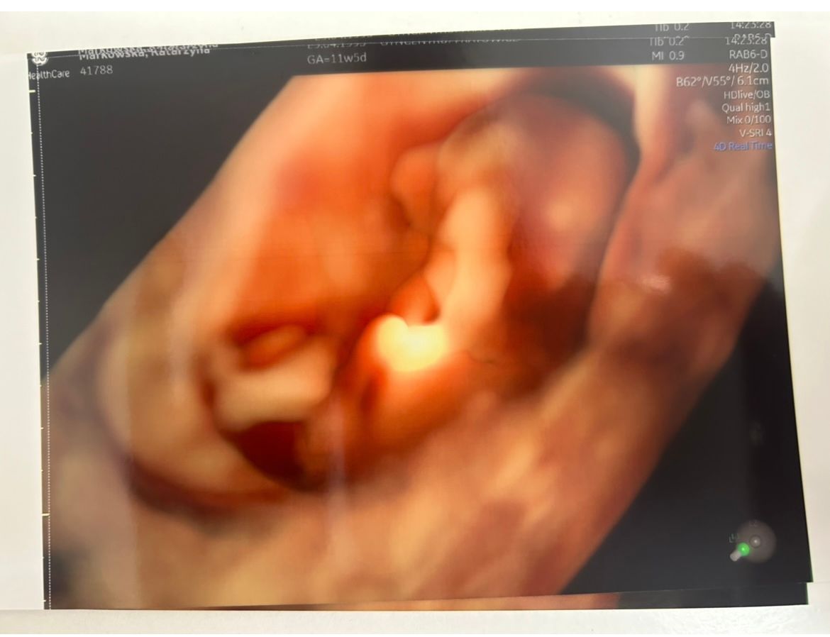 Wioletta Rozmus-Warcholińska-119