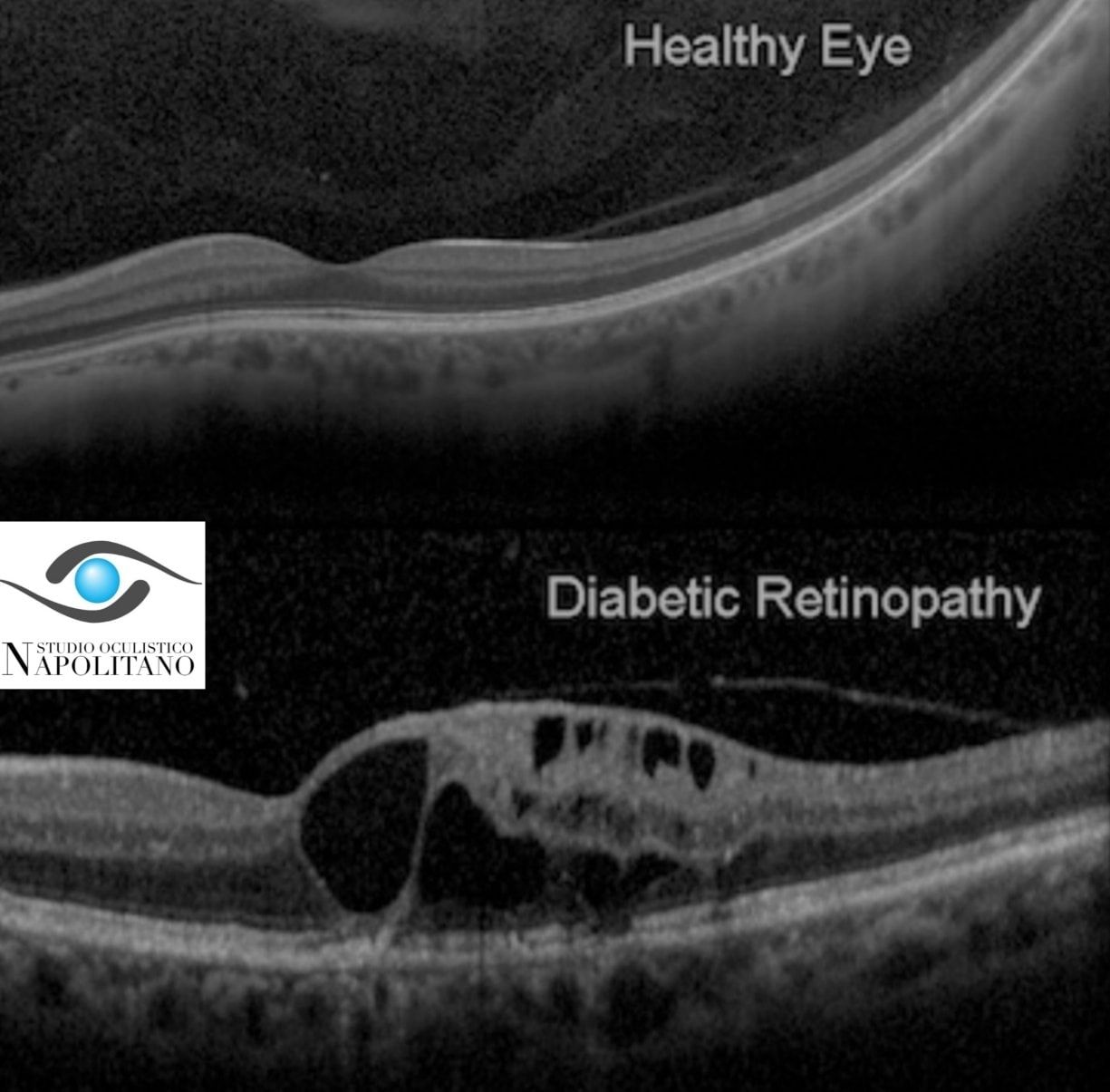 Pasquale Napolitano-19