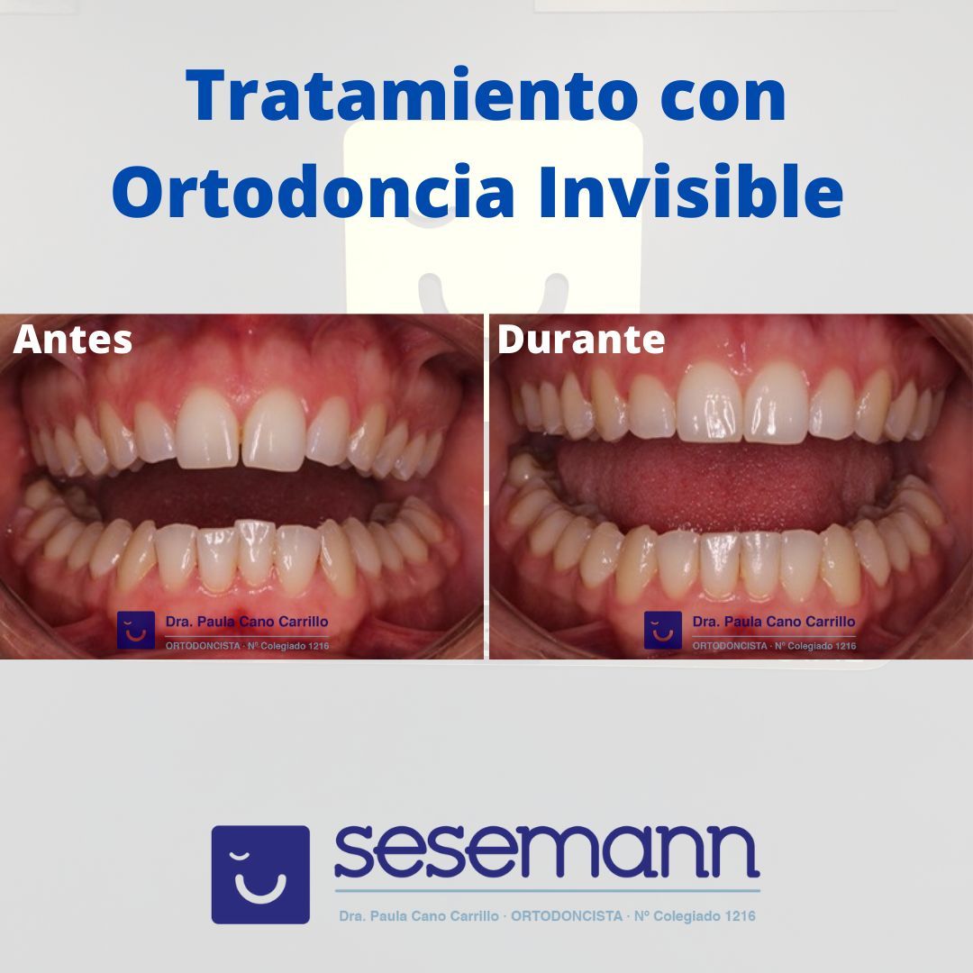 Paula Cano Carrillo-102