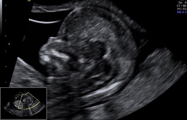 Maksymilian Kurkowski-4