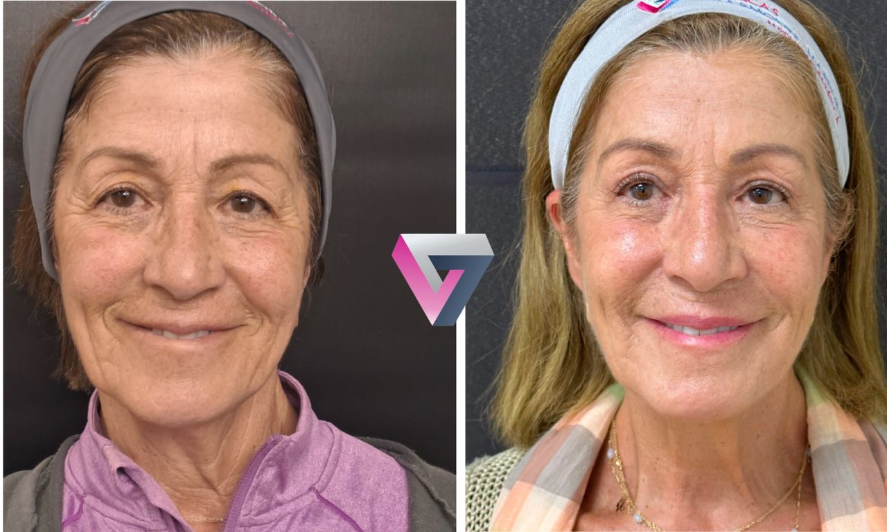 Victoria Trasmonte-84