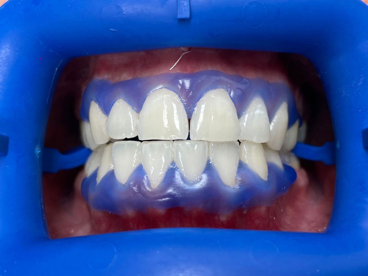 César Buján Riveiro-11