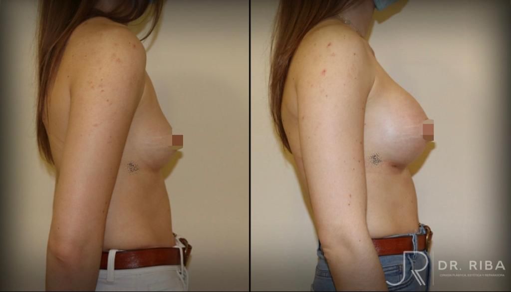 Jordi Riba Vilchez-57