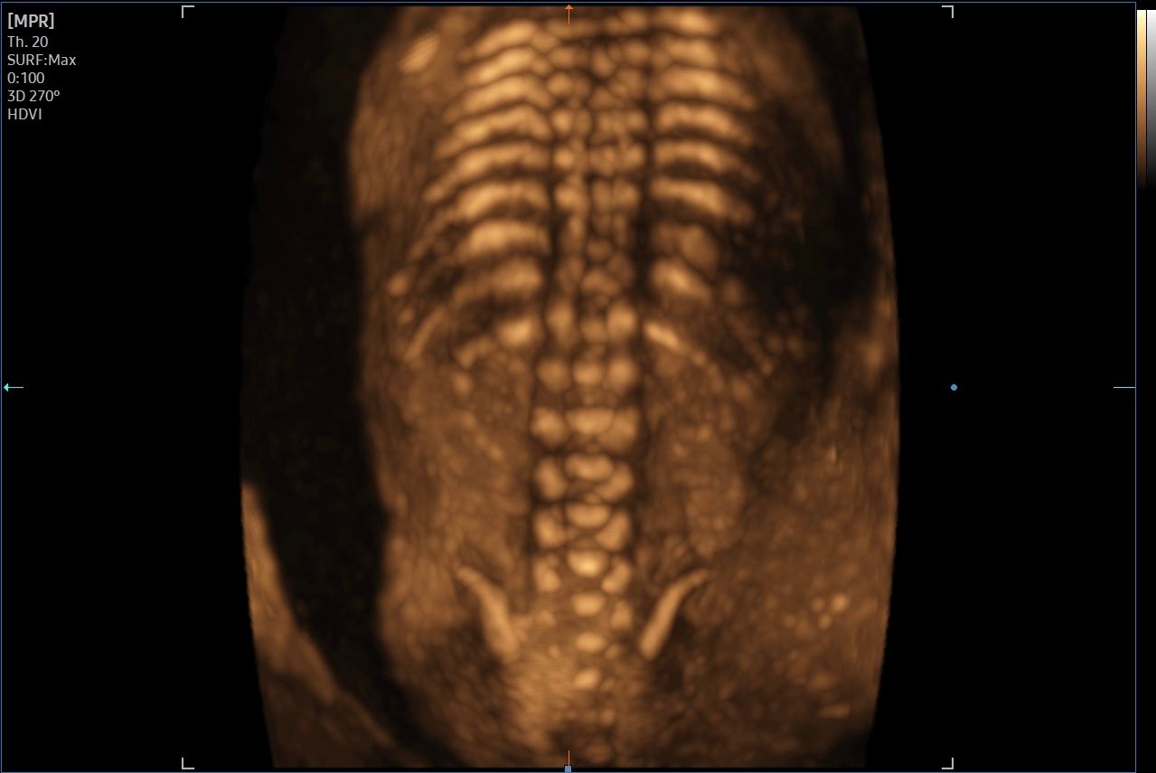 Valentina Del Negro-6