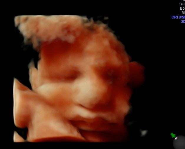 Tommaso Incandela-60