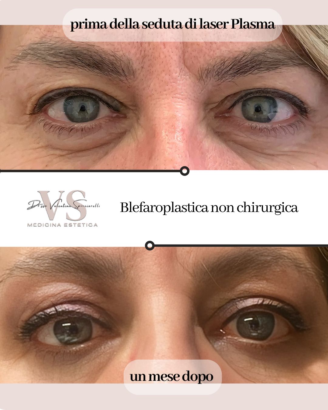 Valentina Spicciarelli-3