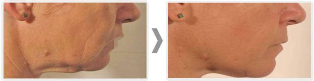 Anita Orzechowska-19