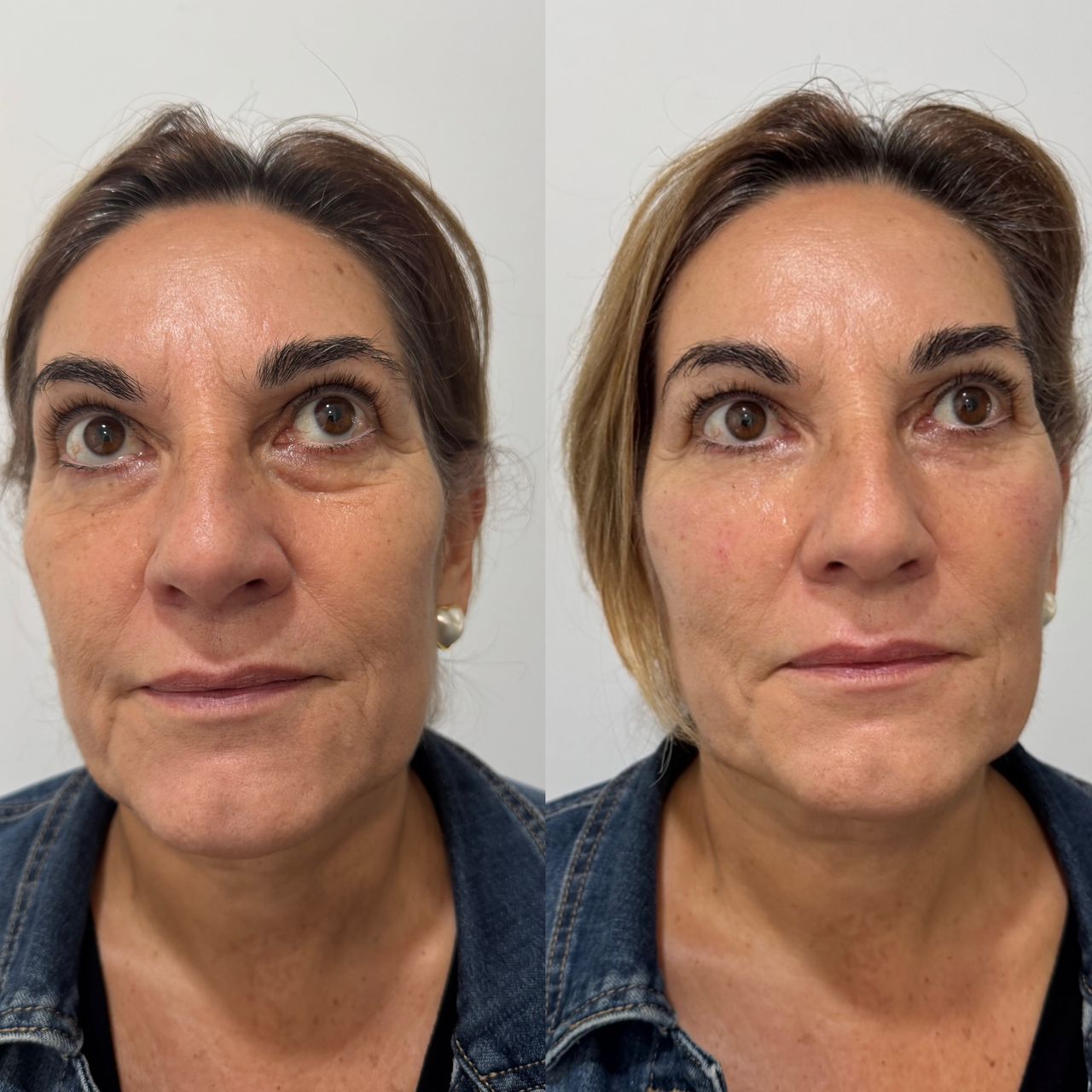 Andrea Catahysa Del Torto-0