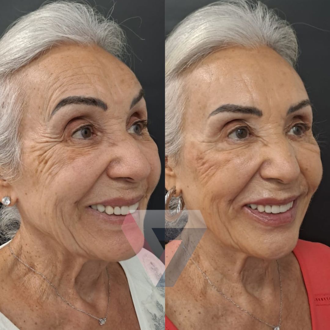 Victoria Trasmonte-125