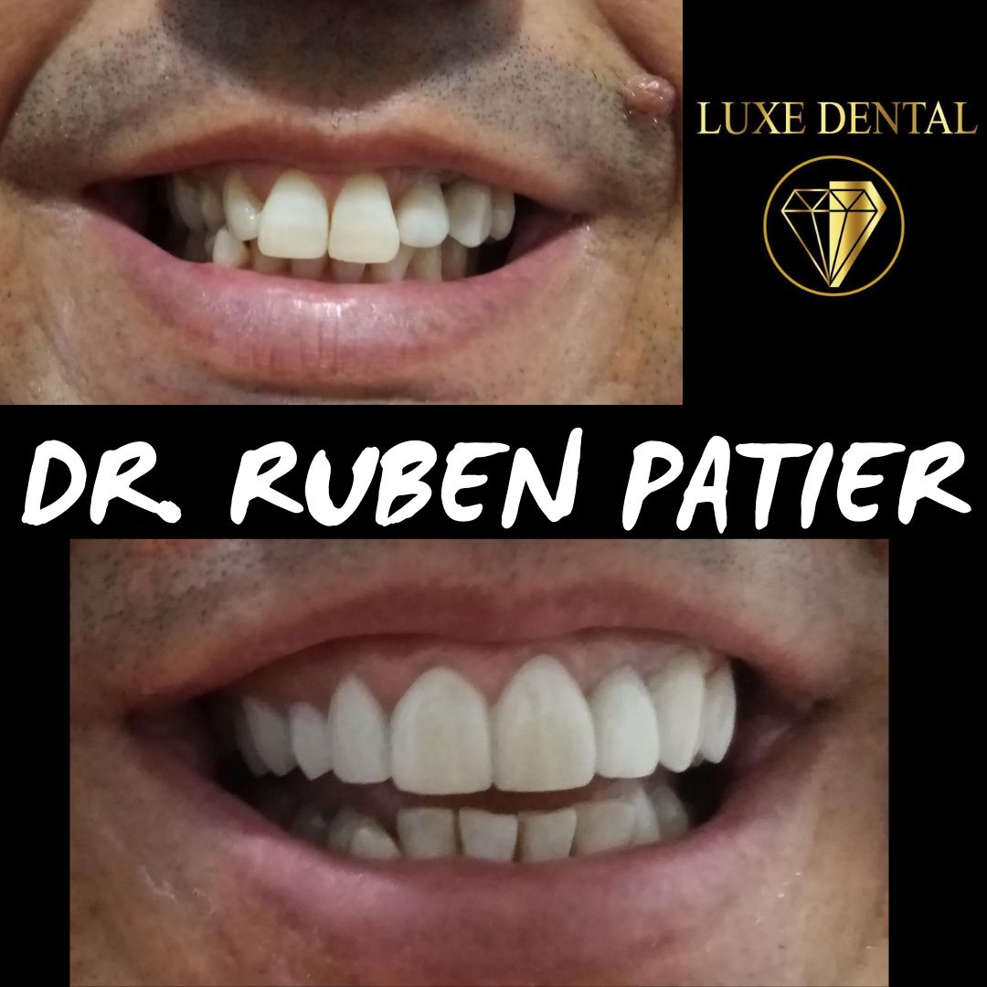 Ruben Patier Martin-19