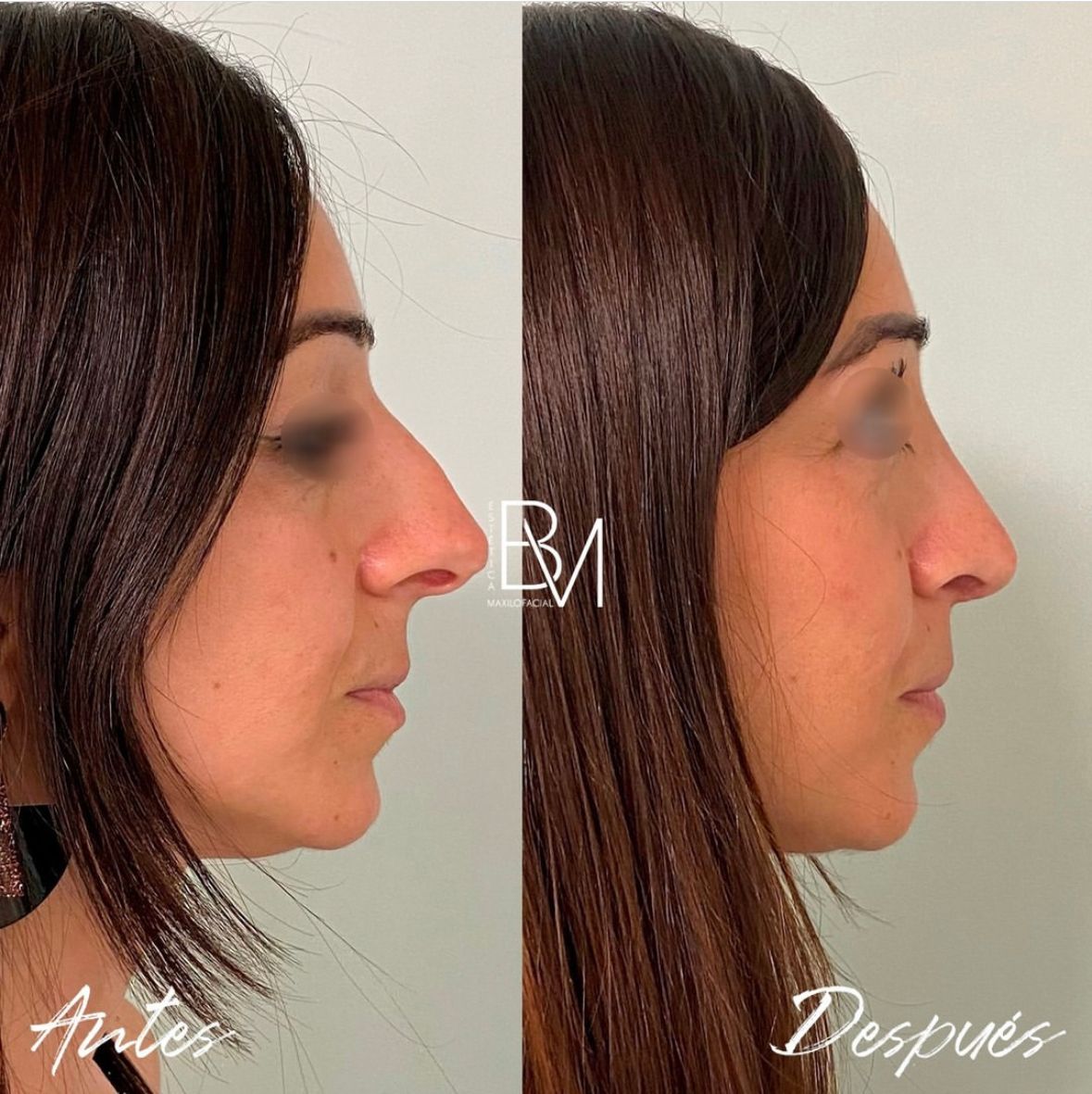Beatriz Moralejo-64