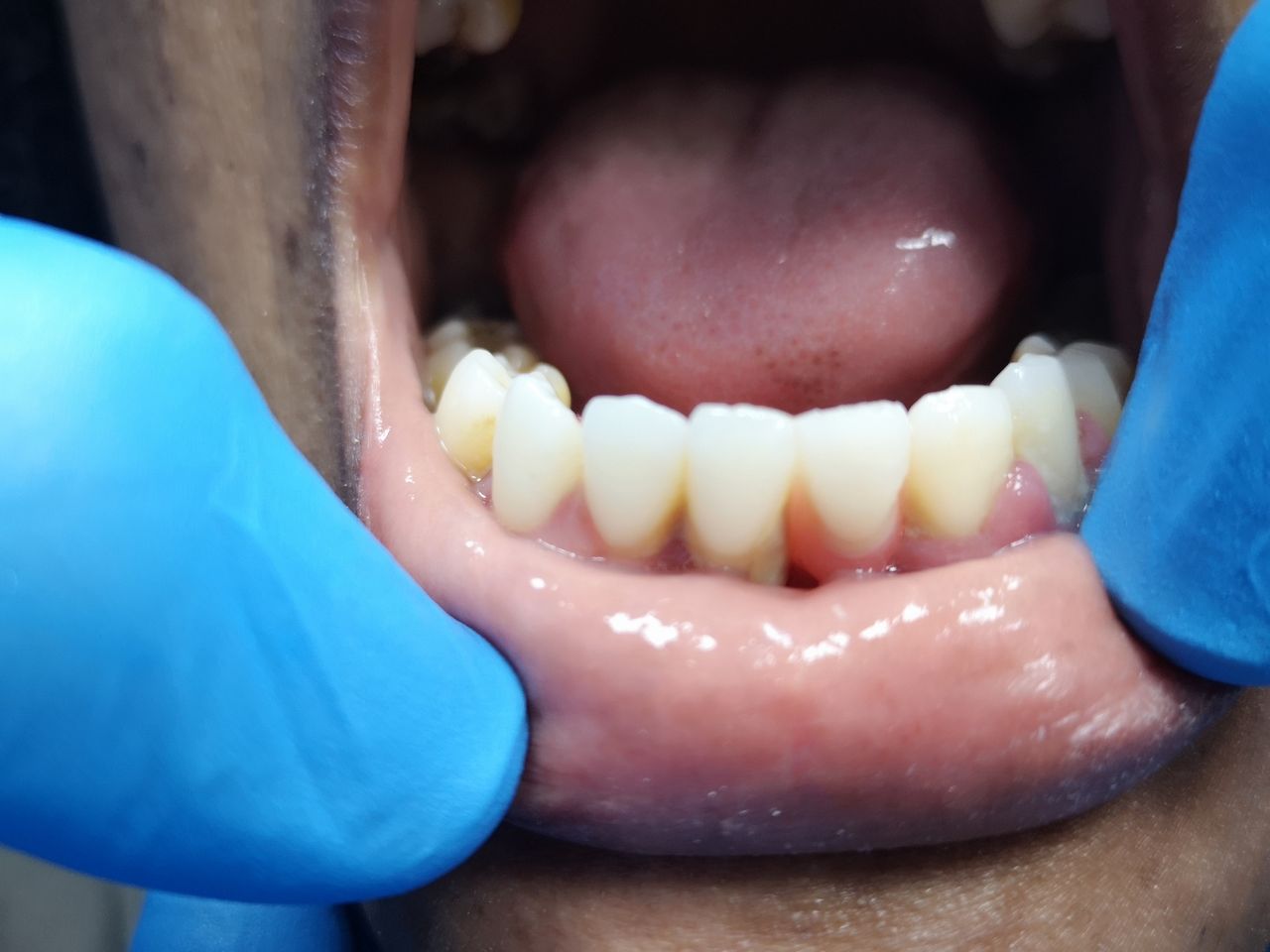 Stefano De Simone-72