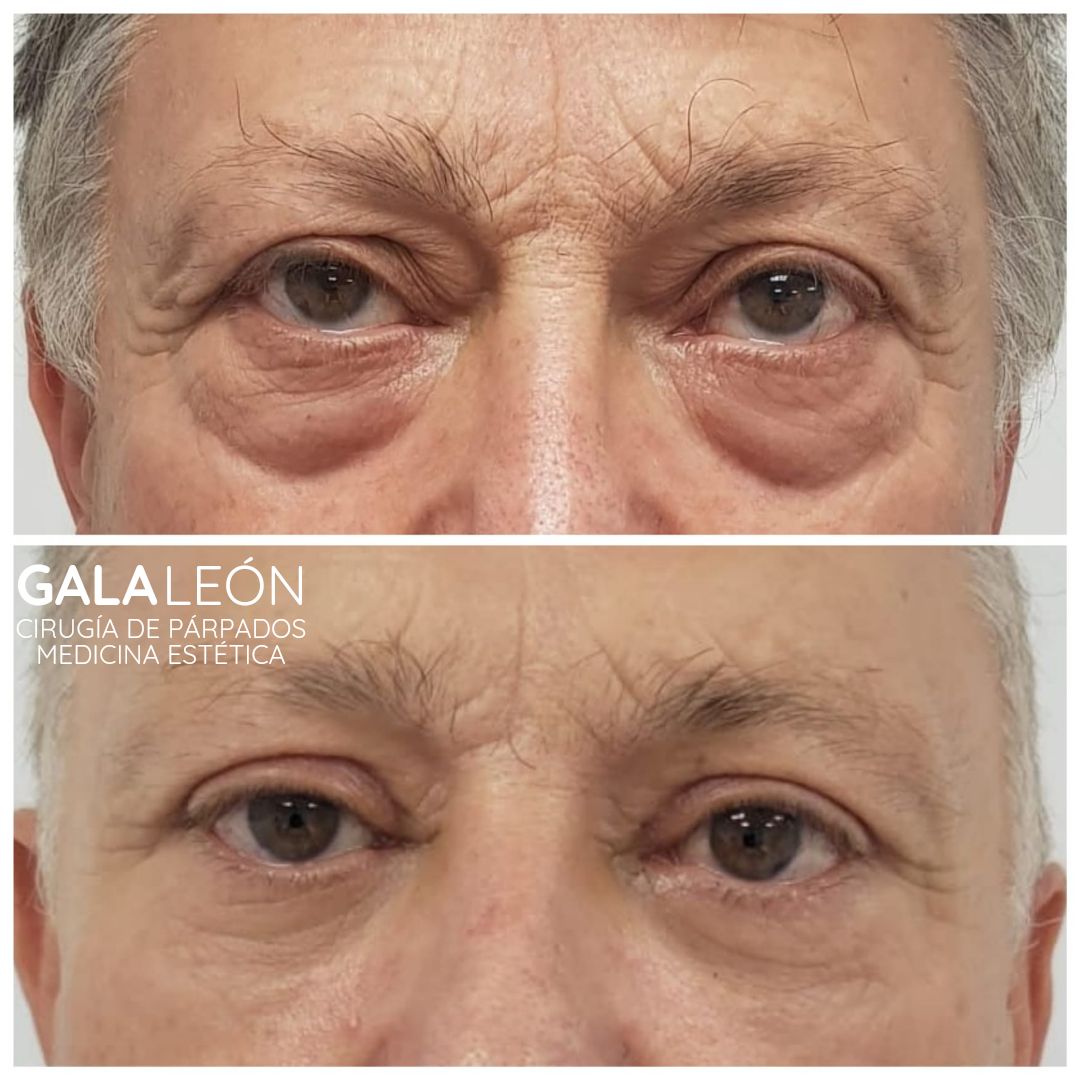 Gala P. Leon Salvatierra-31