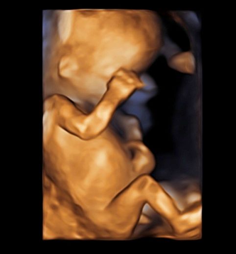 Tommaso Incandela-18