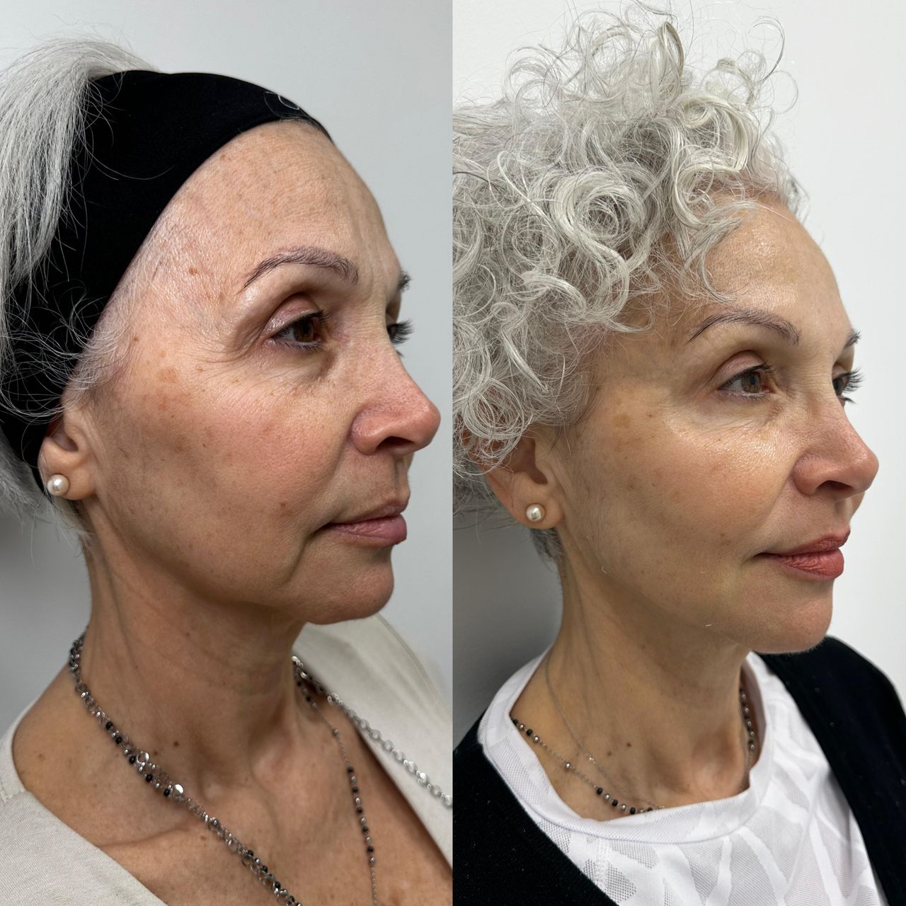 Yamel Giangreco Abchi-6