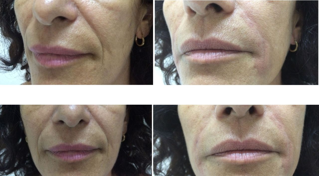 Virginia Cristina Rapisarda-45