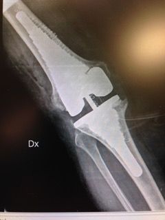 Francesco Augusto Lagrasta-5