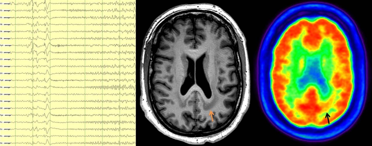 Ángel Aledo Serrano-1