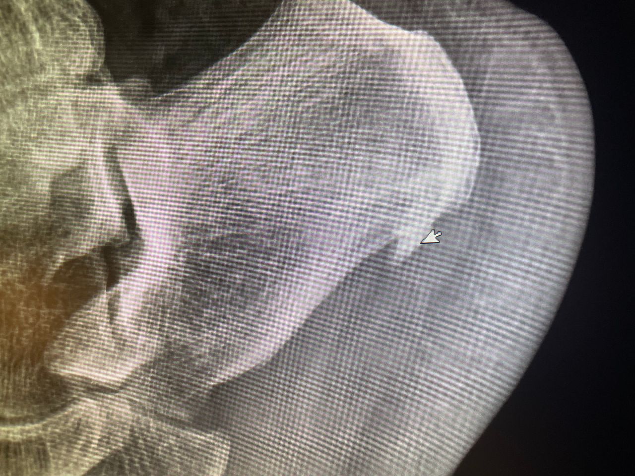 Giuseppe Lombardo-35