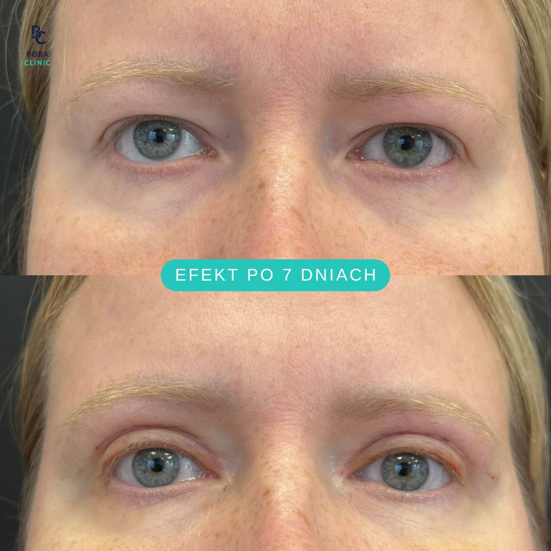 Anastasiia Grechyshkina-9