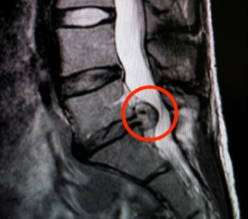 Daniele Millimaggi-5