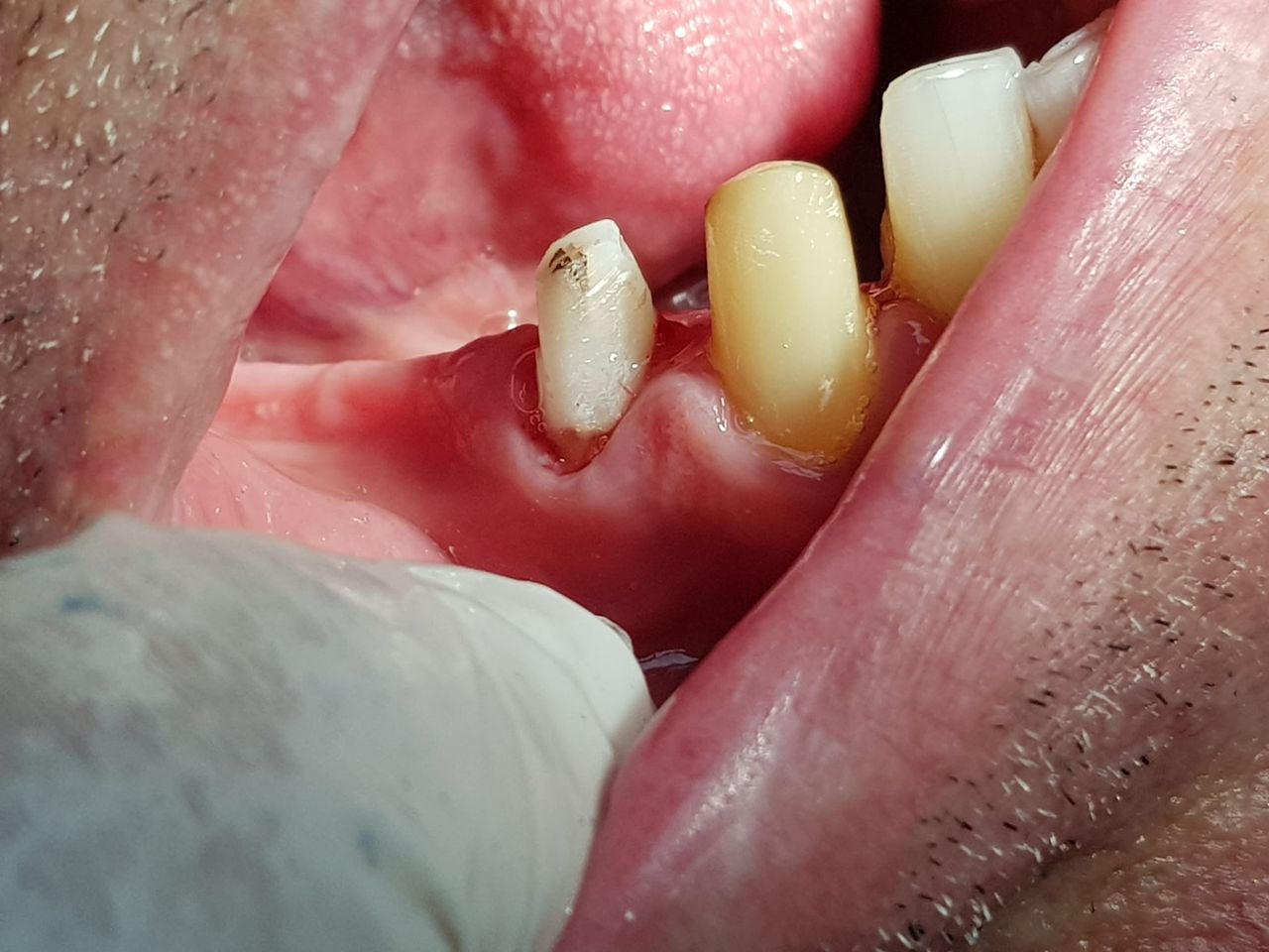 Stefano De Simone-94