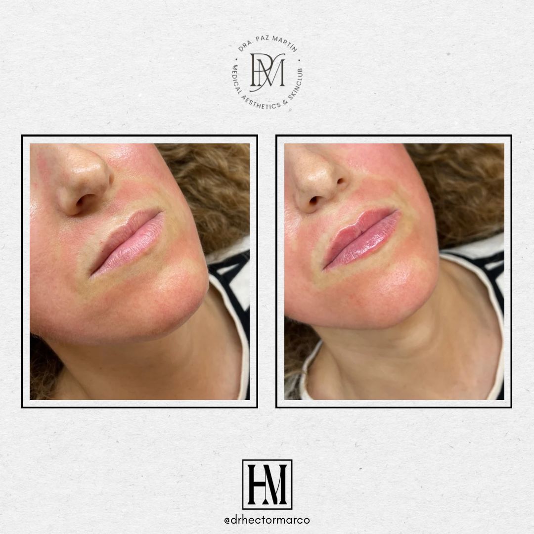 Héctor Marco Ruiz-14