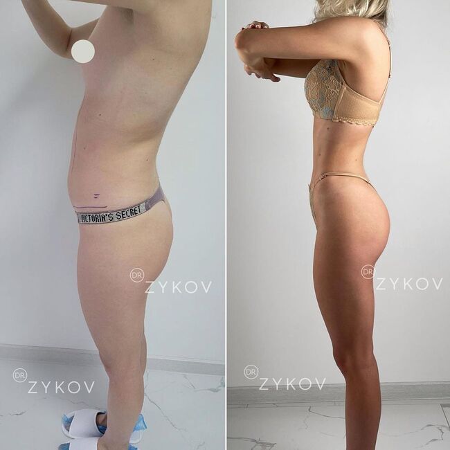 Valentin Zykov-24