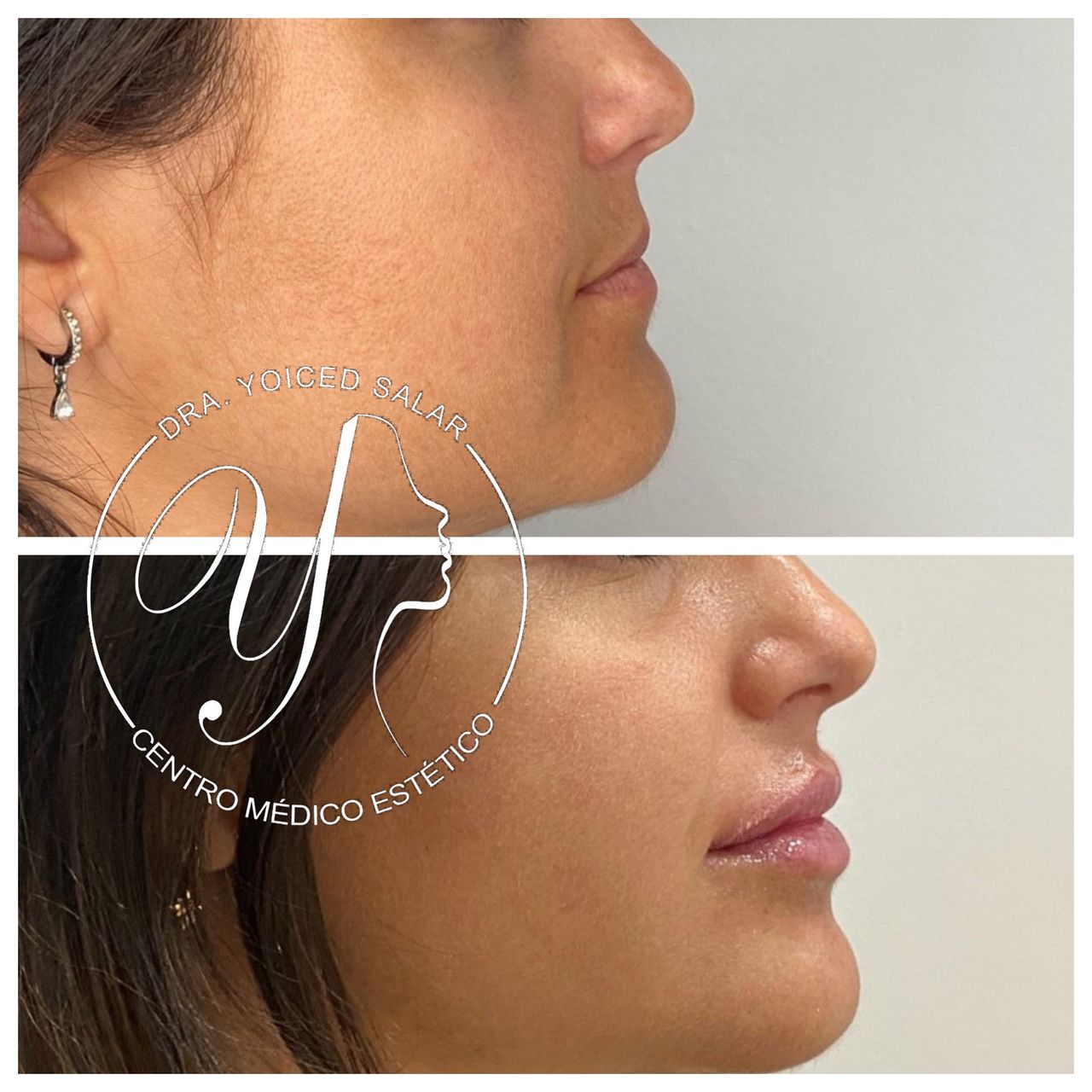 Yoiced Salar Peñate-13