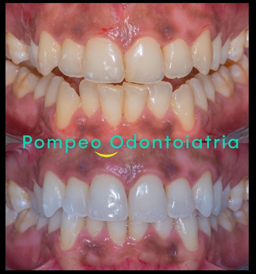 Enrico Maria Pompeo-2