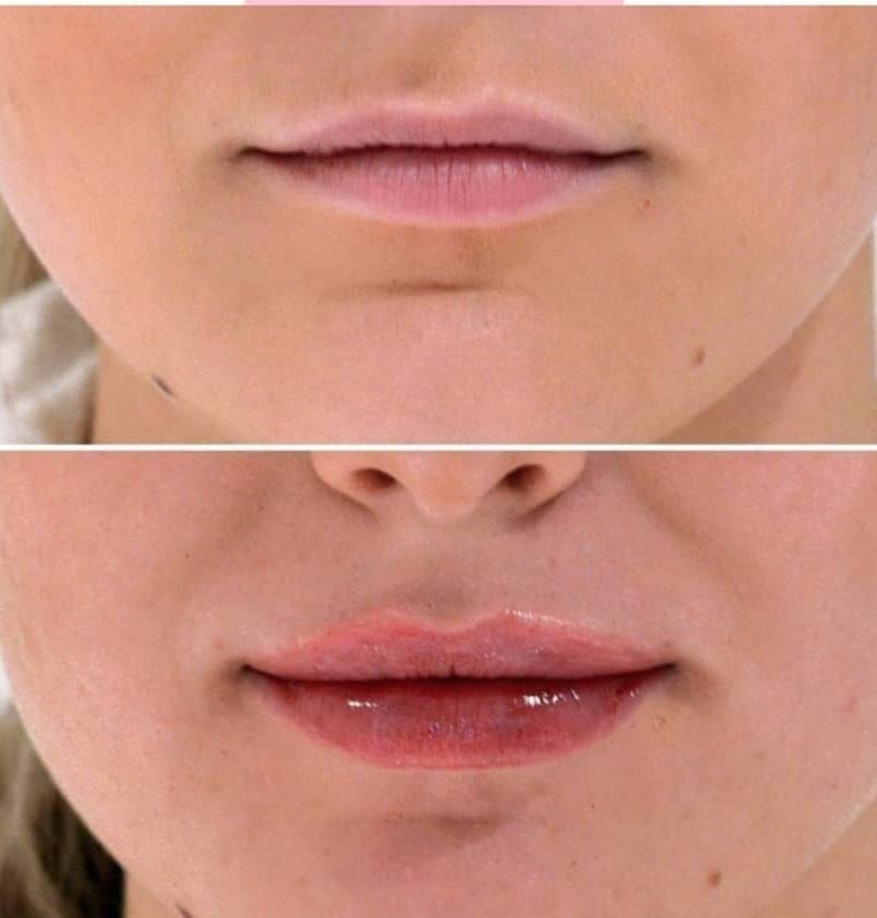 Lorella Di Battista-4