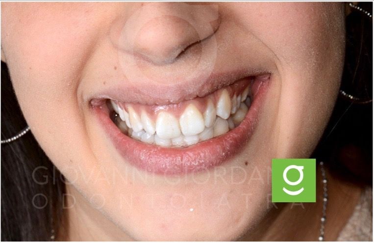 Giovanni Giordano-14