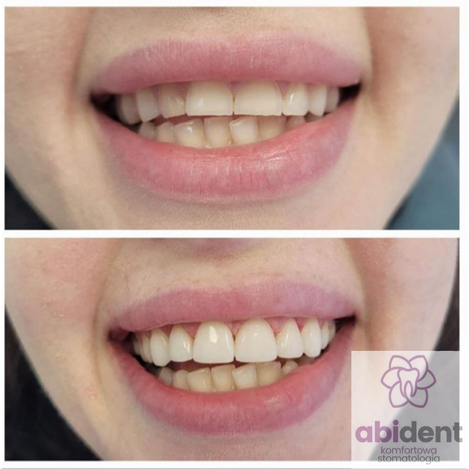 Katarzyna Korfanty-5