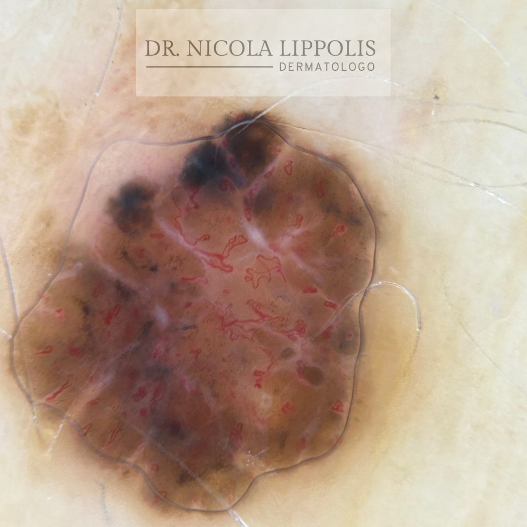 Nicola Lippolis-3