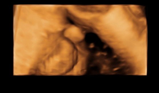 Tommaso Incandela-43