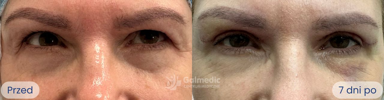 Jakub Staniszewski-8