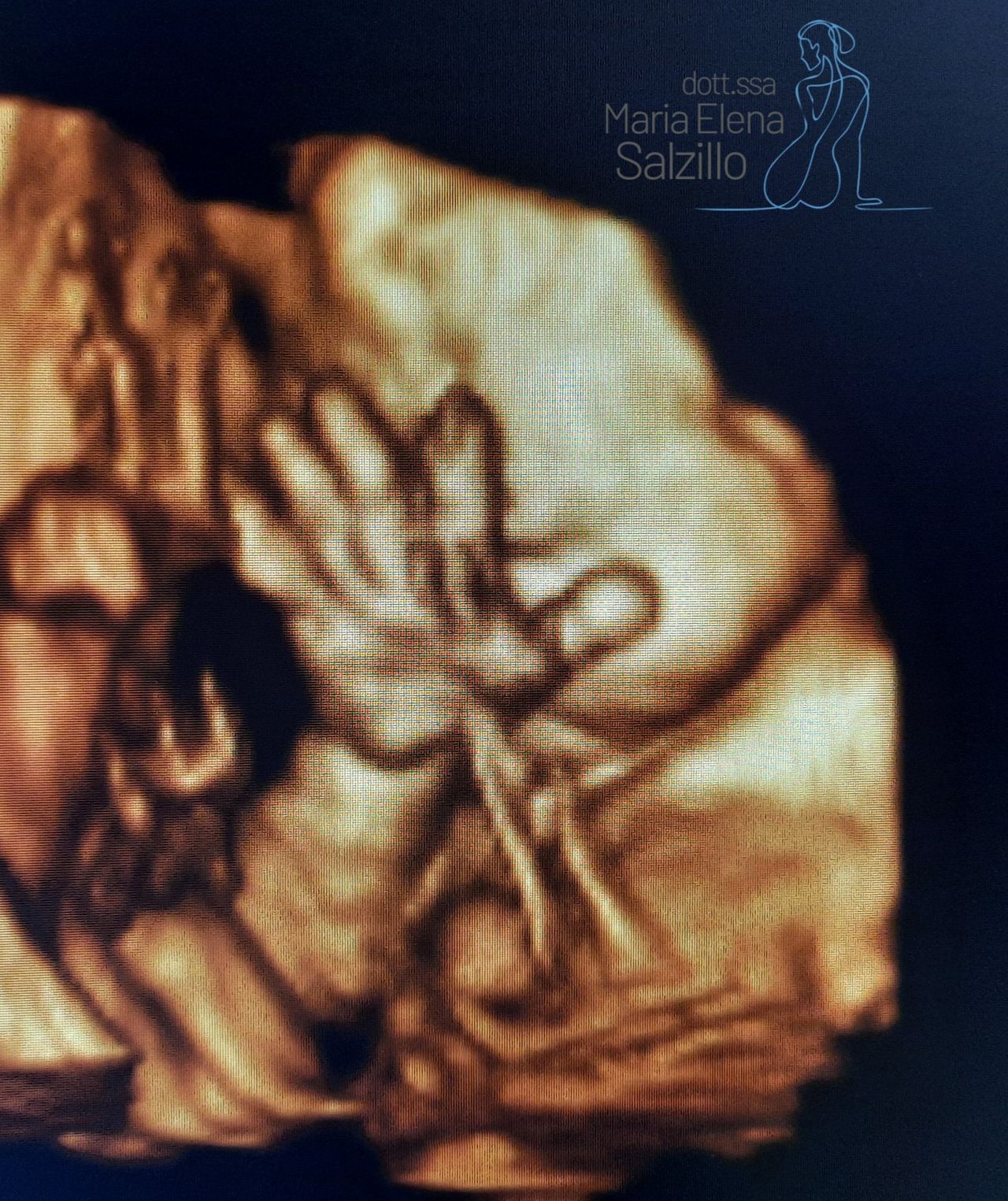 Maria Elena Salzillo-3