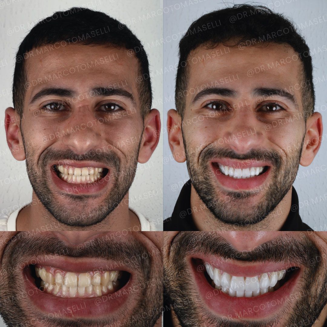 Marco Tomaselli-1