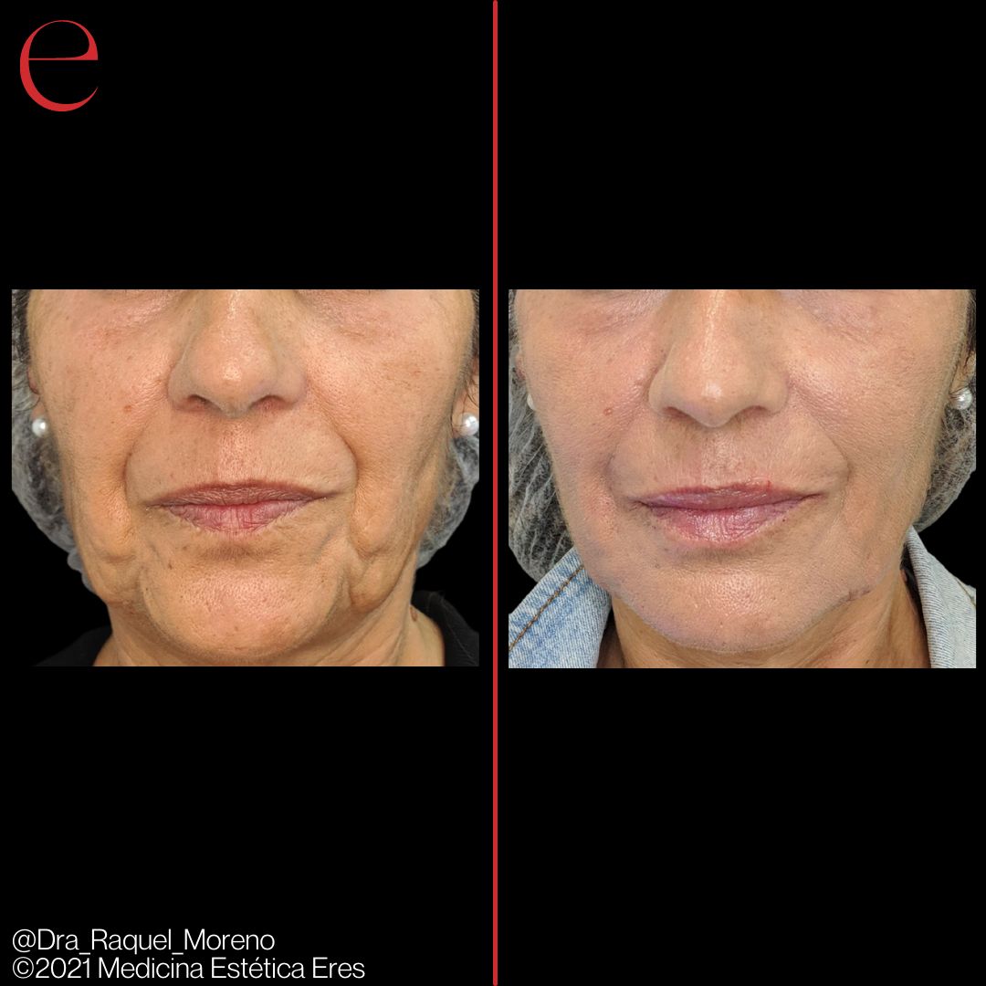 Raquel Moreno Pentinel-98