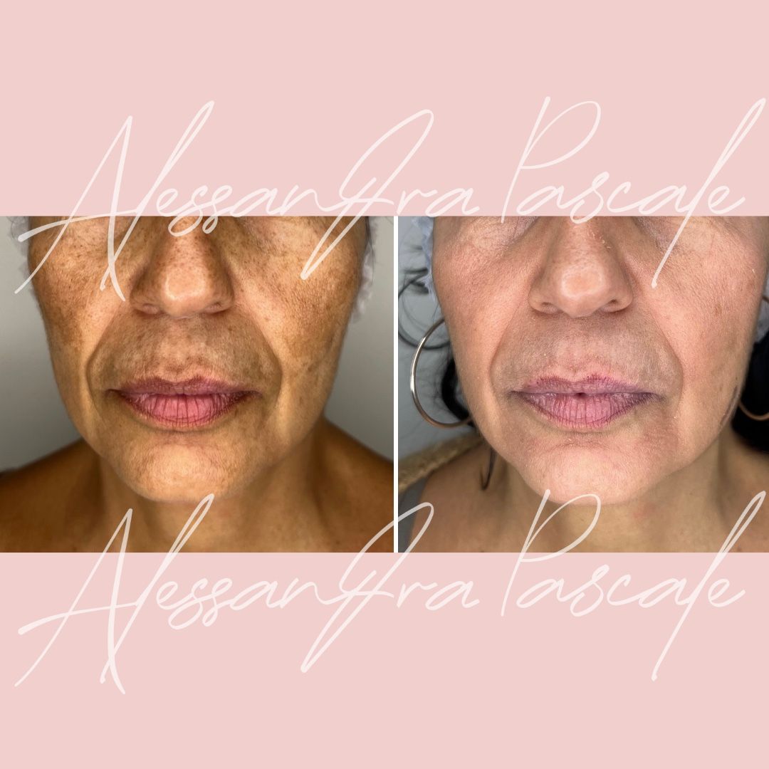 Alessandra Pascale-6